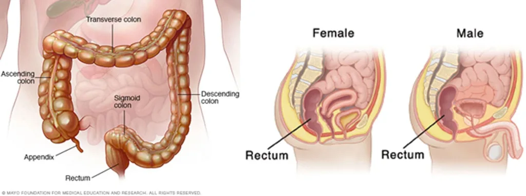 Anal pain, things you have to know 1 reasons you never knew behind rectal pain - C J Global Newspaper