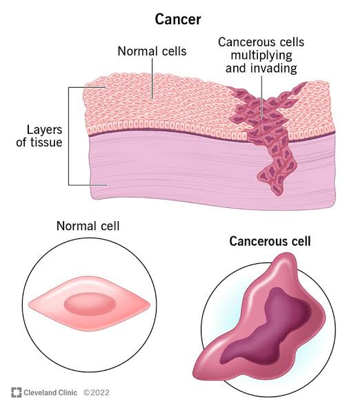 Pancreatic Cancer Risk Linked to Alcohol Consumption, Says New UN Study 3 IMG 7963 - C J Global Newspaper
