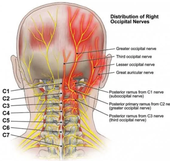Occipital Nerve Decompression for Occipital Neuralgia: A Promising Solution 1 IMG 8181 - C J Global Newspaper