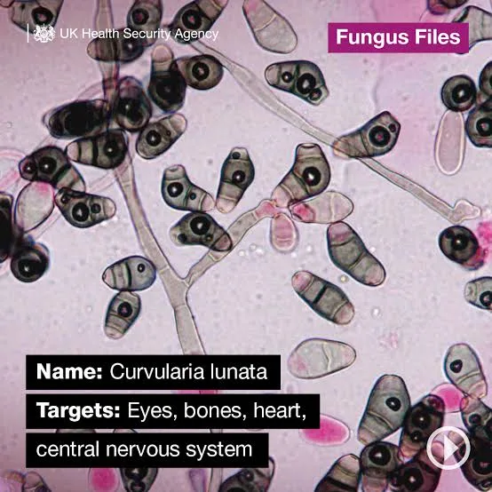 Deadly Candida auris Fungus Spreads in UK, Raises Global Health Concerns 1 IMG 8284 - C J Global Newspaper