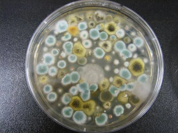Deadly Candida auris Fungus Spreads in UK, Raises Global Health Concerns 4 IMG 8285 - C J Global Newspaper