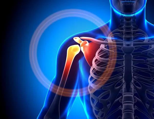 Shoulder Pain After Neck Surgery: Understanding the Causes and Finding Relief 2 IMG 8472 - C J Global Newspaper