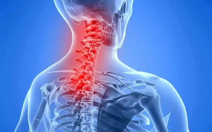 Shoulder Pain After Neck Surgery: Understanding the Causes and Finding Relief 1 IMG 8475 - C J Global Newspaper